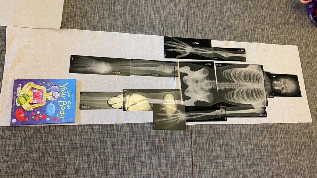 10.28.22 Montessori Xray skeleton (1)